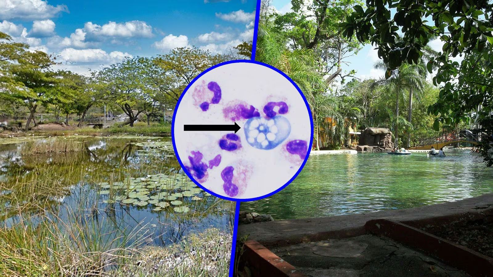 Clausuran 6 lagos artificiales en Mérida por ameba comecerebros Naegleria fowleri