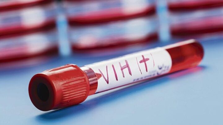 VIH: una nueva combinación de medicamentos de acción prolongada logra mantener el virus indetectable durante casi dos años
