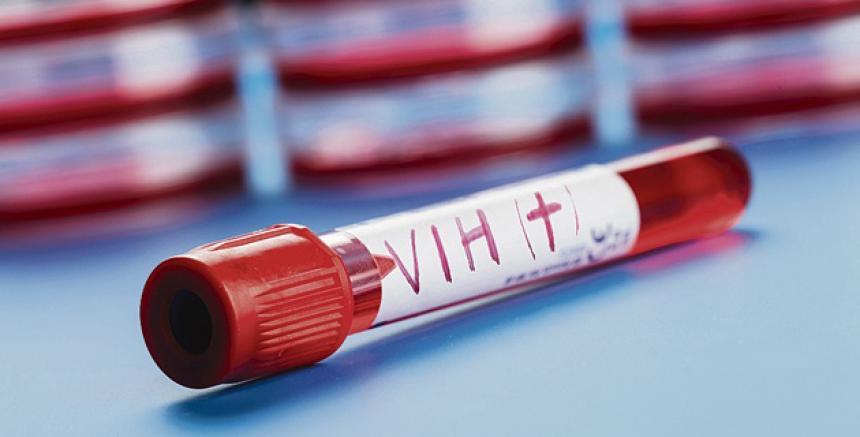 VIH: una nueva combinación de medicamentos de acción prolongada logra mantener el virus indetectable durante casi dos años